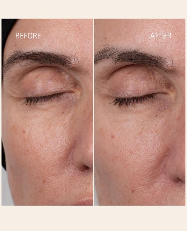 Before and after using FLOREA A.M. Beauty Serum – reduction in fine lines and rough texture, visibly smoother, brighter skin with botanical actives and hydrating ingredients.